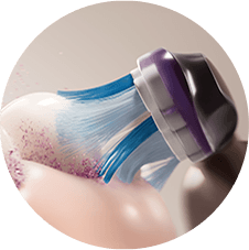 Zbliżenie na szczoteczkę usuwającą z zębów rozbitą płytkę.